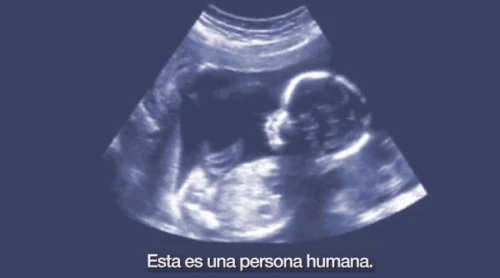 Este sencillo video muestra la realidad del aborto y defiende la vida