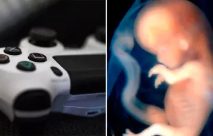 Imagen referencial (izquierda) - Crédito: Unsplash / Embrión de 9 a 10 semanas (derecha) - Crédito: Steven O'Connor, M.D., Houston Texas. 