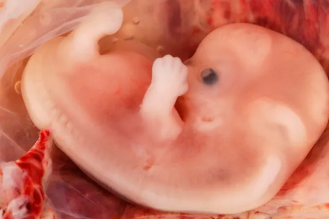 Arzobispo denuncia: ¿Cuidamos animales pero despreciamos embriones humanos?