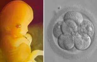 Embrión de 7 semanas y embrión de 8 células / Fotos: Dominio Público  