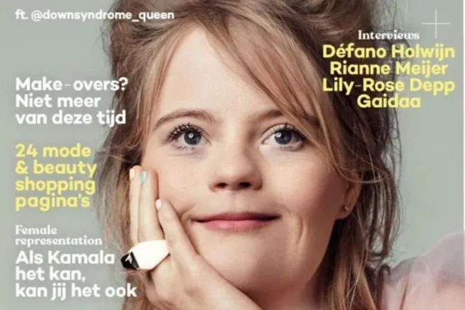 Joven influencer con síndrome de Down es portada de conocida revista de modas