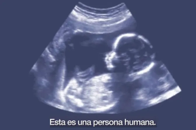 Este sencillo video muestra la realidad del aborto y defiende la vida