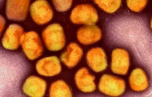 Virus de la viruela del mono. Crédito: Instituto Nacional de Alergias y Enfermedades Infecciosas de Estados Unidos (NIAID), (CC BY 2.0). 