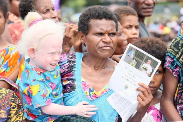 A woman with an albino child attends the meeting with Pope Francis in Vanimo, Papua New Guinea. Credit: Daniel Ibáñez / EWTN News.