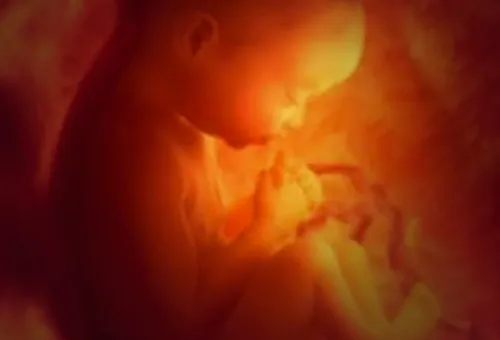 Bebé colombiana sobrevivió a aborto y la llaman 