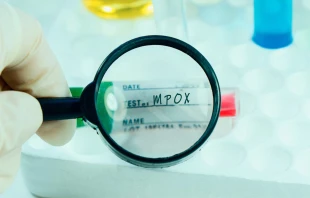 La Organización Mundial de la Salud calificó recientemente el recrudecimiento de la viruela del mono (mpox) en República Democrática del Congo como "una emergencia de salud pública de importancia internacional". Crédito: Shutterstock.