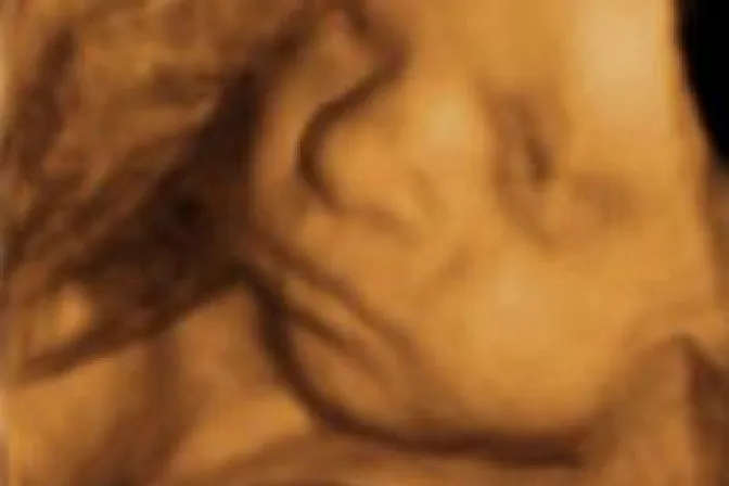 Texas: Firman ley que obliga a realizarse ultrasonido antes de aborto
